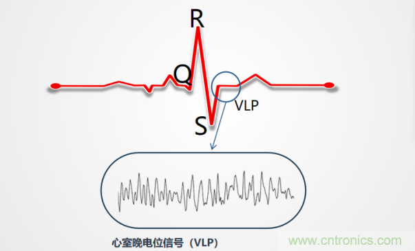 解決心電監測行業(yè)難題，曼森伯格的濾波技術(shù)獲國家知識產(chǎn)權局發(fā)明授權
